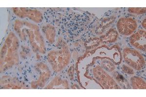 Detection of OPN in Human Kidney Tissue using Polyclonal Antibody to Osteopontin (OPN) (Osteopontin Antikörper  (AA 18-314))