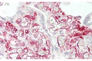 Detection of CD32 in Human Placenta Tissue using Polyclonal Antibody to Cluster Of Differentiation 32 (CD32) (Fc gamma RII (CD32) (AA 69-309) Antikörper)