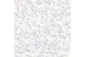 Immunohistochemistry of paraffin-embedded Human liver using TROP-2 antibody (ABIN7271103) at dilution of 1:2700 (40x lens). (TACSTD2 Antikörper)