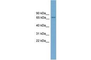 Image no. 1 for anti-Protein Kinase C, eta (PRKCH) (AA 35-84) antibody (ABIN6746461)