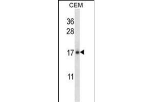 IL21 Antibody (C-term) (ABIN657761 and ABIN2846740) western blot analysis in CEM cell line lysates (35 μg/lane). (IL-21 Antikörper  (C-Term))
