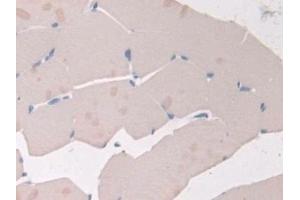 Immunohistochemistry (IHC) image for anti-Adiponectin Receptor 2 (ADIPOR2) (AA 1-147) antibody (ABIN7431158)