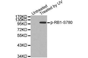 Western blot analysis of extracts from 3T3 cells, using Phospho-RB1-S780 antibody. (Retinoblastoma 1 Antikörper  (pSer780))