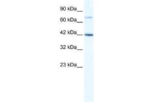 WB Suggested Anti-GLI4 Antibody Titration:  1. (GLI4 Antikörper  (N-Term))