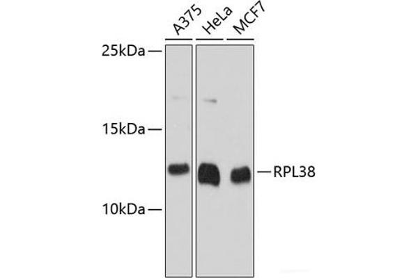 RPL38 抗体