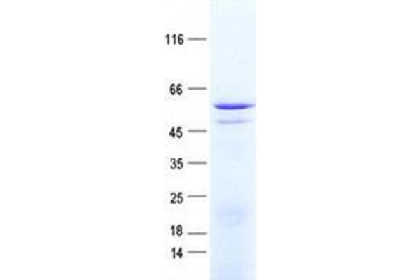 ZNF529 Protein (His tag)