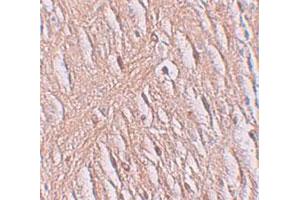 Immunohistochemical staining of human brain cells with SLC39A9 polyclonal antibody  at 2.
