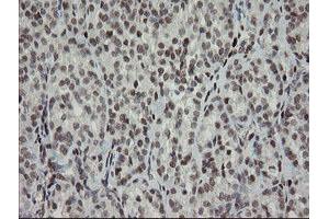 Image no. 1 for anti-Transducin-Like Enhancer of Split 1 (E(sp1) Homolog, Drosophila) (TLE1) (AA 180-460) antibody (ABIN1491050)