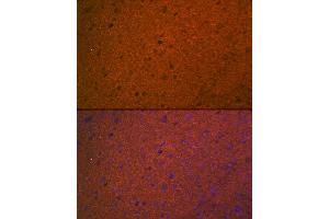 Immunofluorescence analysis of mouse brain using STX1A Rabbit mAb (ABIN7270684) at dilution of 1:100 (40x lens). (STX1A Antikörper)