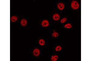 ABIN6274880 staining 293 by IF/ICC. (ABCA6 Antikörper  (Internal Region))