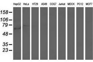 Western blot analysis of extracts (35 µg) from 9 different cell lines by using anti-ARHGAP25 monoclonal antibody. (ARHGAP25 Antikörper)