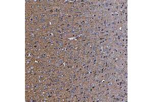 IHC analysis of TTC7B using anti-TTC7B antibody (ABIN7601050). (TTC7B Antikörper  (AA 275-730))