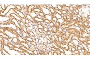 Immunohistochemistry (IHC) image for anti-Vascular Endothelial Growth Factor A (VEGFA) (AA 27-214) antibody (ABIN7428479)