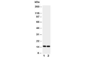 Western blot testing of FABP5 antibody and Lane 1:  rat liver
