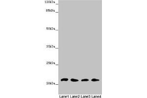 Western blot All lanes: MSRB3 antibody at 4. (MSRB3 Antikörper  (AA 1-185))