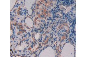 Used in DAB staining on fromalin fixed paraffin- embedded thyroid tissue (CD164 Antikörper  (AA 24-162))