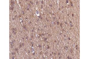 ABIN6266533 at 1/100 staining human brain tissue sections by IHC-P. (COL18A1 Antikörper  (C-Term))