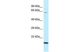 Image no. 1 for anti-DnaJ (Hsp40) Homolog, Subfamily C, Member 11 (DNAJC11) (AA 407-456) antibody (ABIN6747790) (DNAJC11 Antikörper  (AA 407-456))