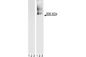 Western Blot analysis of TRA-1-60 in mouse and human ES cell lines. (TRA1-60 Antikörper)