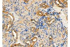 ABIN6260581 and ABIN6277918 at 1/100 staining Rat kidney tissue by IHC-P. (CD166 Antikörper  (N-Term))