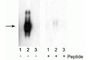 Western blot of immunoprecipitates from HEK 293 cells transfected with 1) Mock, 2) IFNAR1 WT, and 3) IFNAR1 S535A and S539A mutants. (IFNAR1 Antikörper  (pSer535, pSer539))