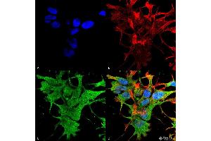 Immunocytochemistry/Immunofluorescence analysis using Mouse Anti-Dicer Monoclonal Antibody, Clone S167-7 . (DICER1 Antikörper  (AA 1638-1899))