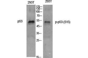 Western Blot (WB) analysis of specific cells using Phospho-p53 (S15) Polyclonal Antibody. (p53 Antikörper  (pSer15))