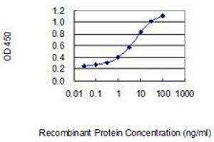 Detection limit for recombinant GST tagged DKK1 is 0.
