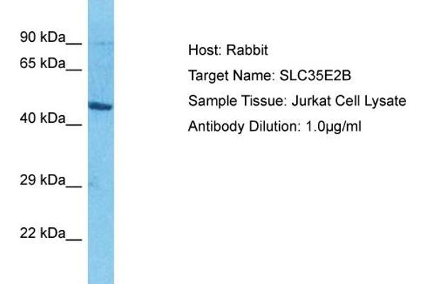 SLC35E2B antibody  (N-Term)