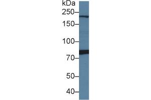 Detection of PI4Ka in Rat Cerebrum lysate using Polyclonal Antibody to Phosphatidylinositol-4-Kinase Catalytic Alpha (PI4Ka)