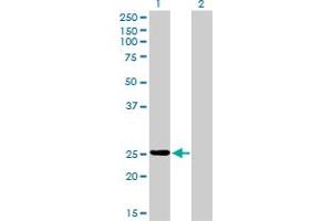 Western Blot analysis of PSPH expression in transfected 293T cell line by PSPH monoclonal antibody (M02), clone 2G9. (PSPH Antikörper  (AA 1-225))