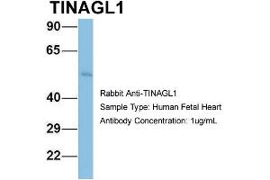 Host: Rabbit Target Name: TINAGL1 Sample Type: Human Fetal Heart Antibody Dilution: 1. (TINAGL1 Antikörper  (Middle Region))