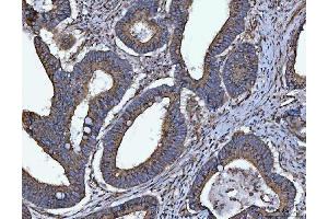 IHC analysis of HMGCR using anti-HMGCR antibody (ABIN7600989). (HMGCR Antikörper  (AA 268-842))