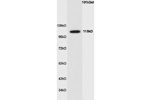 Human colon cancer lysate probed with Anti Phospho-Ack1(Tyr284) Polyclonal Antibody, Unconjugated  at 1:3000 for 90 min at 37˚C. (TNK2 Antikörper  (pTyr284))