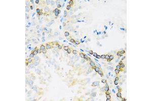 Immunohistochemistry (IHC) image for anti-Fragile X Mental Retardation 1 (FMR1) (AA 500-600) antibody (ABIN6140719)
