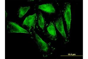 Immunofluorescence of monoclonal antibody to RFNG on HepG2 cell. (RFNG Antikörper  (AA 82-190))