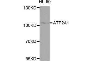 Western blot analysis of extracts of HL-60 cells, using ATP2A1 antibody. (ATP2A1/SERCA1 Antikörper)