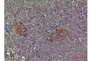 Immunohistochemistry (IHC) analysis of paraffin-embedded Human Pancreas, antibody was diluted at 1:100. (CMTM5 Antikörper  (N-Term))