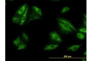 Immunofluorescence of monoclonal antibody to SQSTM1 on HeLa cell. (SQSTM1 Antikörper  (AA 1-440))