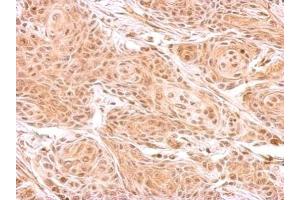 IHC-P Image ZNF134 antibody detects ZNF134 protein at cytosol on Cal27 xenograft by immunohistochemical analysis.