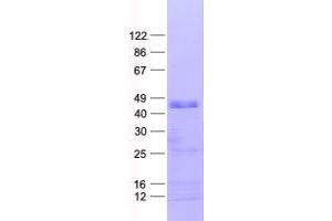 Validation with Western Blot (ZNF3 Protein (His tag))