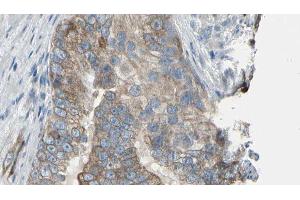 ABIN6276452 at 1/100 staining Human prostate tissue by IHC-P.