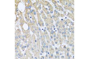 Immunohistochemistry (Paraffin-embedded Sections) (IHC (p)) image for anti-Ubiquinol-Cytochrome C Reductase Core Protein II (UQCRC2) (AA 224-453) antibody (ABIN1683222)