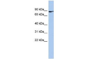 WB Suggested Anti-ZNF189 Antibody Titration:  0.