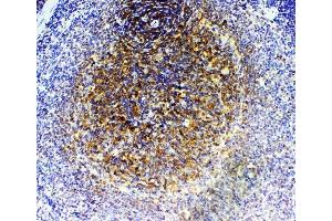 IHC analysis of GRK2 using anti-GRK2 antibody (ABIN5693069). (GRK2 Antikörper)