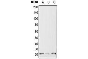 Western blot analysis of RAC2 expression in Jurkat (A), SP2/0 (B), H9C2 (C) whole cell lysates.