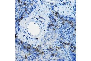 Immunohistochemistry (IHC) image for anti-beta-Transducin Repeat Containing (BTRC) (AA 50-340) antibody (ABIN3022334)