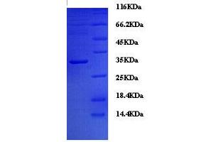 SDS-PAGE (SDS) image for neonatal Fc Receptor (FcRn) (AA 24-297) protein (His tag) (ABIN1643585)