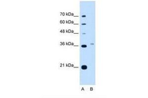 Image no. 2 for anti-Peroxisomal Biogenesis Factor 3 (PEX3) (AA 31-80) antibody (ABIN321040)