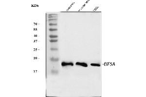 Western blot analysis of EIF5A using anti-EIF5A antibody (ABIN7602568).